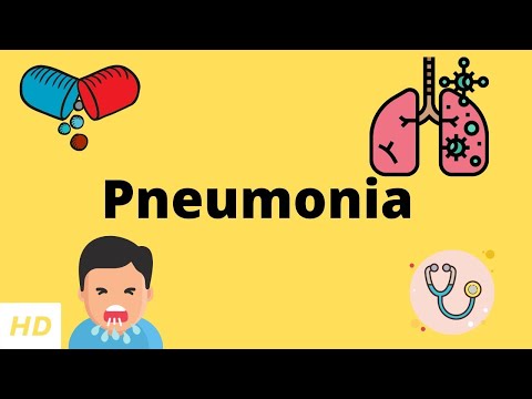 Understanding Fungal Pneumonia: Symptoms and Treatment Options