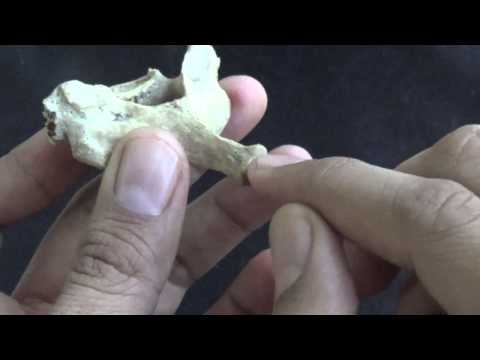 Understanding the Seventh Cervical Vertebra: Anatomy and Care