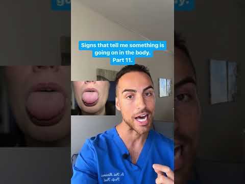 17 Common Mouth and Tongue Issues with Sores and Blisters