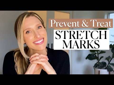 Understanding Pregnancy Stretch Marks: Prevention and Treatment