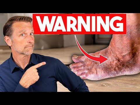 Why Your Feet Hurt and What It Means for You