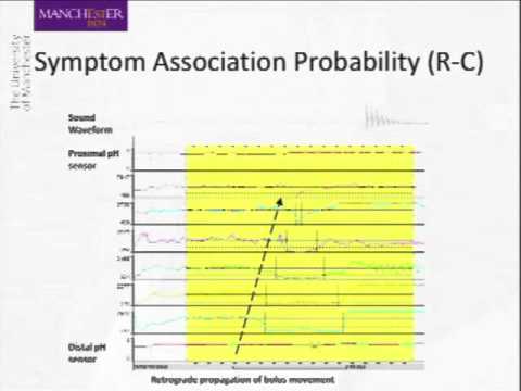 Understanding Acid Reflux: Coughing, Diagnosis, and Treatment