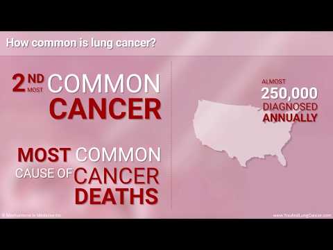 Understanding Squamous Cell Lung Carcinoma: Symptoms and Care