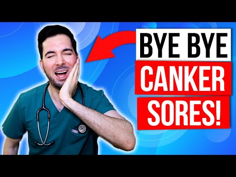 Mouth Sores: Causes, Care, and How to Stay Pain-Free post thumbnail image