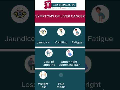 Liver Cancer: Recognizing Symptoms and Avoiding Pitfalls