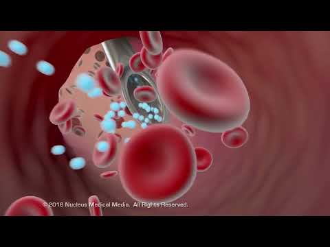 Understanding Motion Relief Tablets: Uses and Side Effects