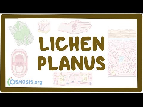 Understanding Lichen Planus: Symptoms, Risks, and Care Options