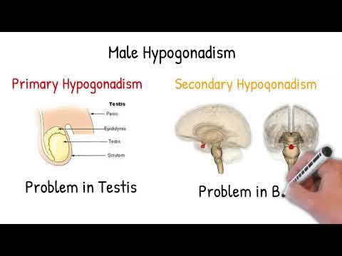 Understanding Hypogonadism: Causes, Symptoms, and Treatments