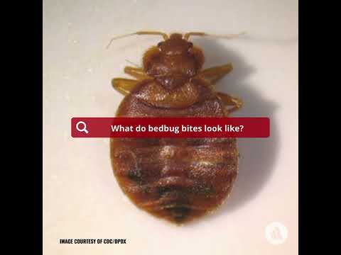 Identifying Bedbug Bites: What to Look For
