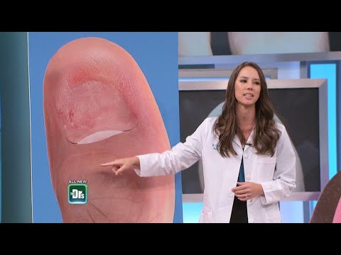 Safe Ways to Remove a Damaged Toenail at Home
