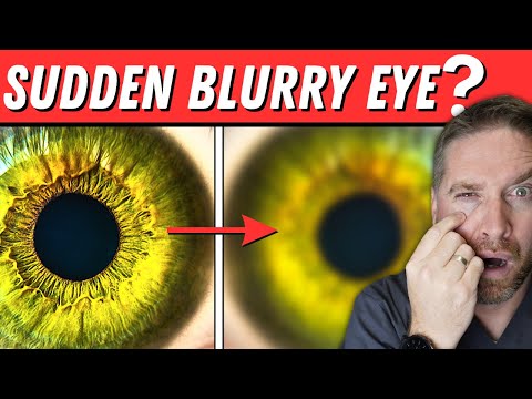 Understanding the Risks of Blurred Vision in One Eye post thumbnail image
