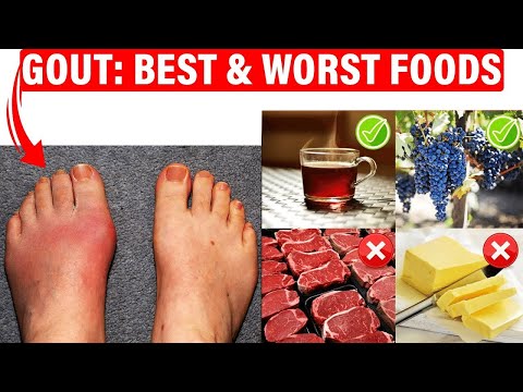 Mastering Your Gout Diet: Foods to Embrace and Avoid