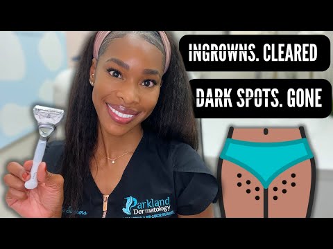 Safe and Smooth: Hair Removal for Your Bikini Line