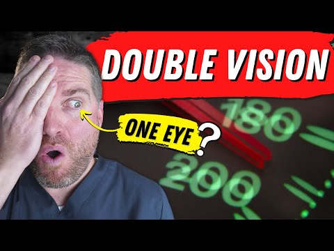 Understanding Double Vision in One Eye: Causes and Care