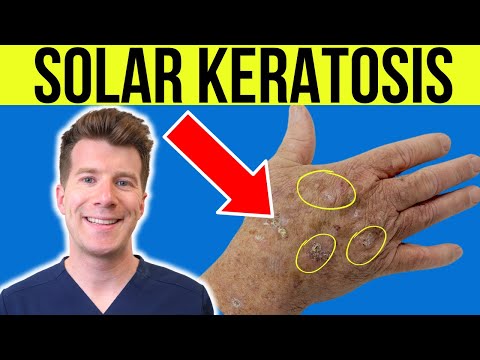 Understanding Actinic Keratosis: Symptoms, Treatment, and Care