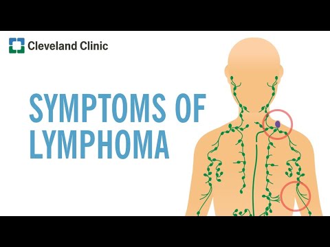 Lymph Node Cancer: What Your Neck Is Trying to Tell You post thumbnail image