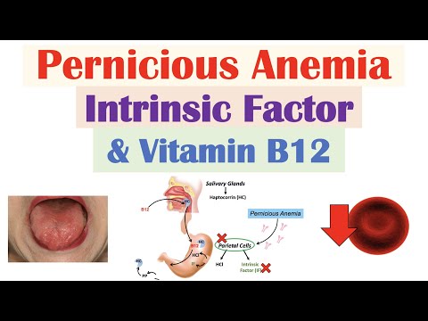 Megaloblastic Anemia: Symptoms, Causes, and Treatments Explained