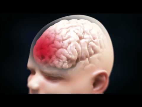 Understanding Why Your Baby Shakes Their Head: What to Know