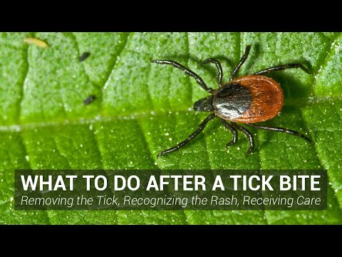 Essential Facts About Tick-Borne Diseases You Should Know