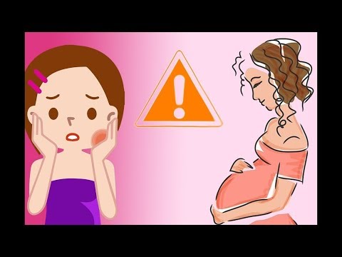 Understanding Threatened Abortion: Key Symptoms and Risks