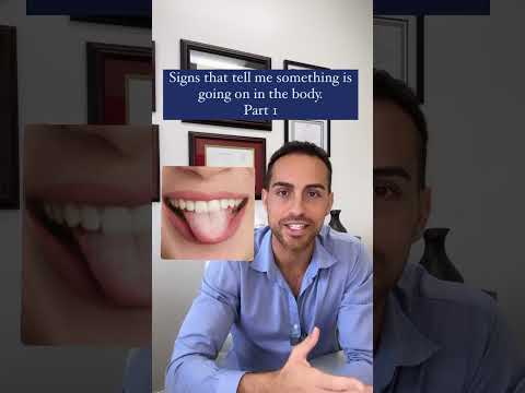 Tongue Troubles: Sores, Discoloration, and Bumps Explained
