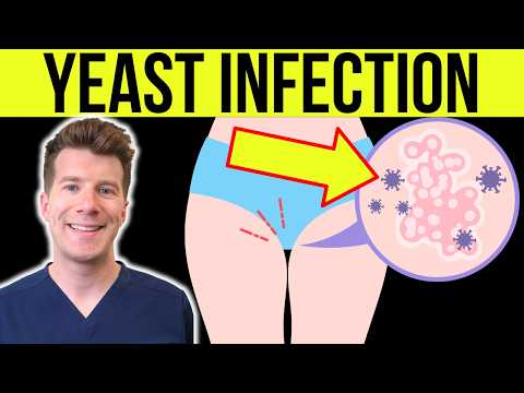 Understanding Rashes Caused by Candida Infections