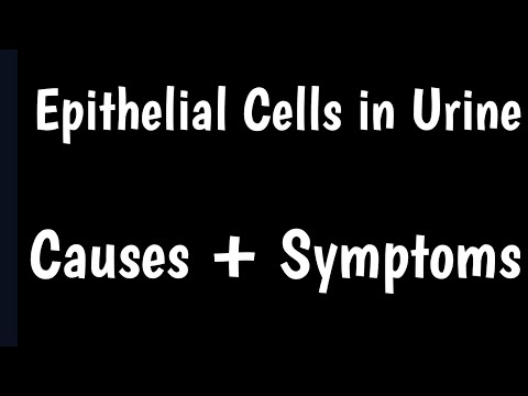 Epithelial Cells in Urine: Types, Causes, and Significance