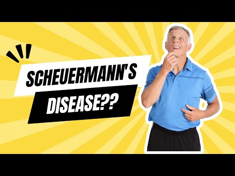 What You Need to Know About Scheuermann’s Kyphosis Care post thumbnail image