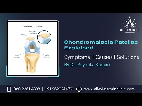 Chondromalacia: Understanding Causes, Symptoms, and Diagnosis post thumbnail image