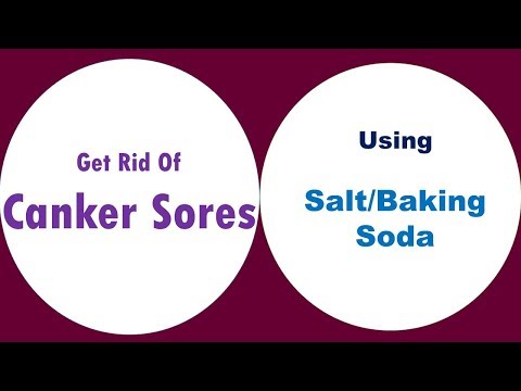 Relief for Canker Sores: Salt, Baking Soda, and More Remedies