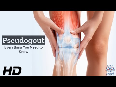 Understanding Crystals That Trigger Gout and Pseudogout Pain