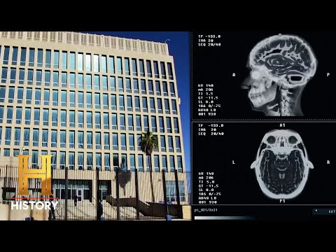 Understanding Havana Syndrome: What History Reveals About Health