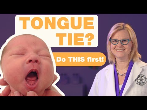 Understanding Tongue-Tie in Babies: Symptoms and Treatment Options