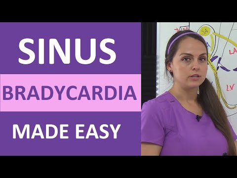 Understanding Sinus Arrhythmia: Symptoms and Prognosis