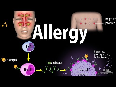 Understanding Ragweed Allergy: Symptoms and Effective Treatments