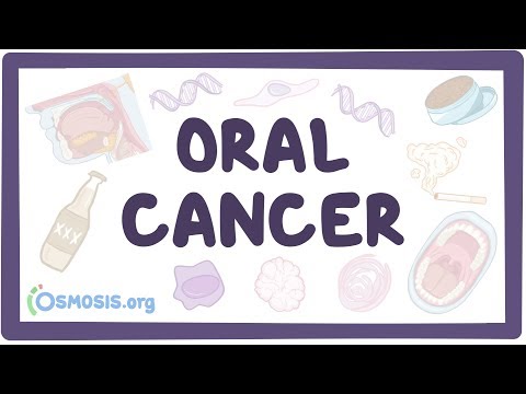 Understanding Oral Cancer: Types, Symptoms, and Treatments