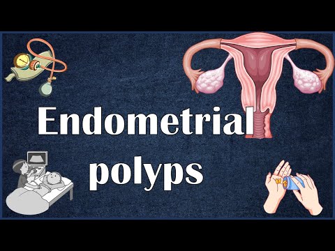 Understanding Proliferative Endometrium: Symptoms to Recognize