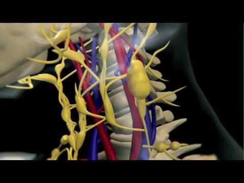 Understanding Spleen Cancer: Causes, Symptoms, and Treatments