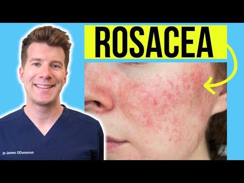 Understanding Dermatosis: Symptoms, Types, and Effective Treatments