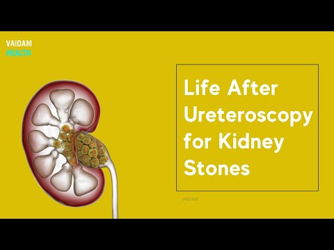 Ureteroscopy: What to Expect from Procedure to Recovery post thumbnail image