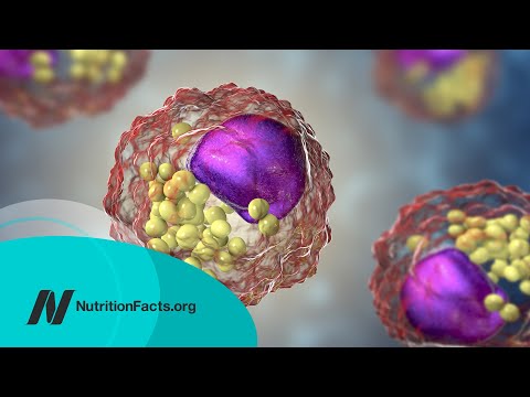 Your Daily Cholesterol Limit: What You Should Aim For