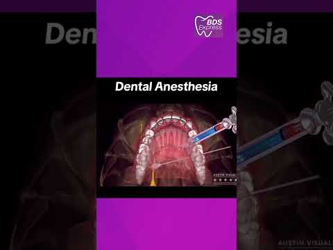 Essential Insights on Dental Anesthesia: Types and Effects