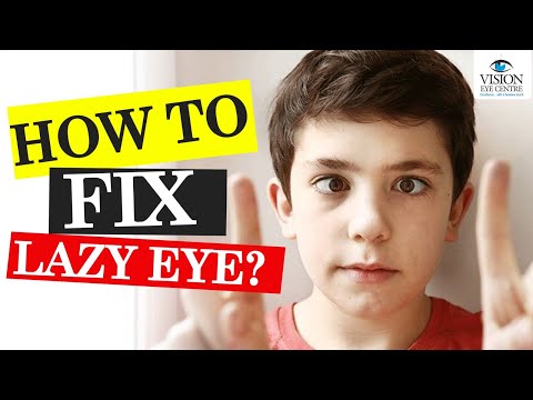 Effective Treatment Options for Fixing a Lazy Eye
