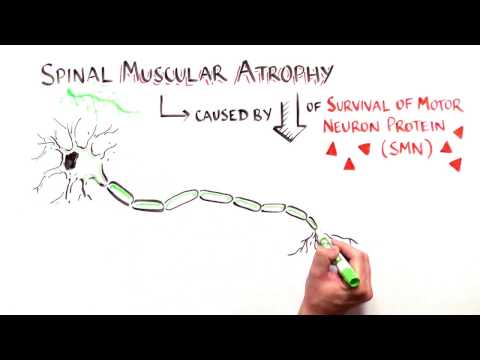 Understanding Spinal Muscular Atrophy: Causes and Care