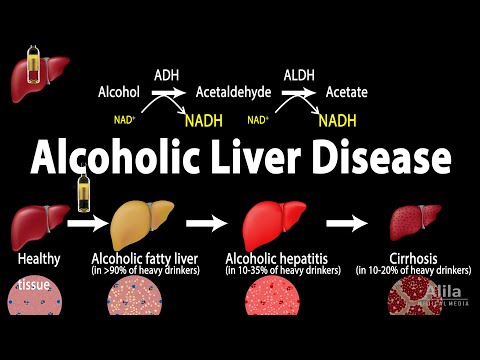 Understanding Liver Disease: Types and Causes Explained