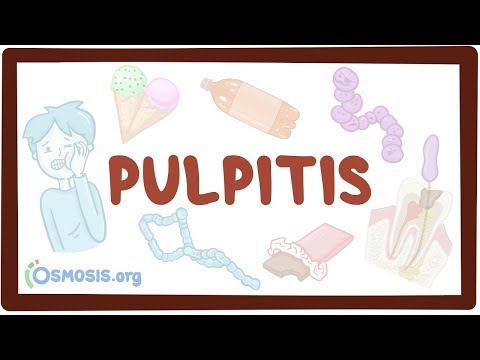 The Role of Tooth Pulp in Inflammation and Dental Health post thumbnail image