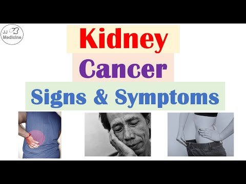 Recognizing the 7 Symptoms of Renal Cell Carcinoma
