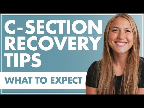 Understanding C-Sections: What Every Expecting Parent Should Know