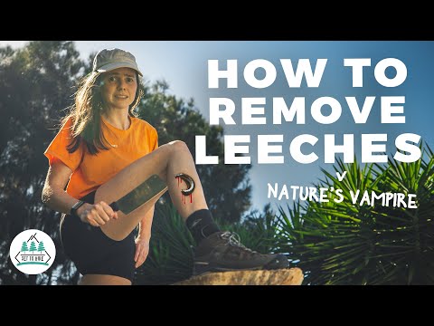 Effective Ways to Safely Remove Leeches from Your Skin