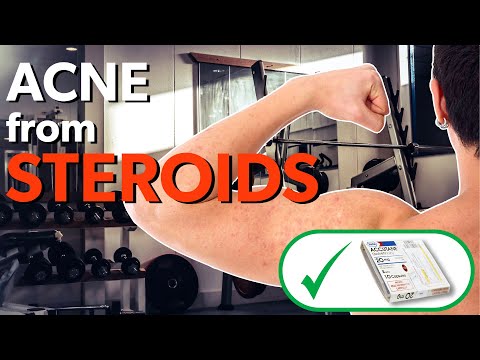 Understanding Steroid Acne: Causes and Effective Treatments post thumbnail image